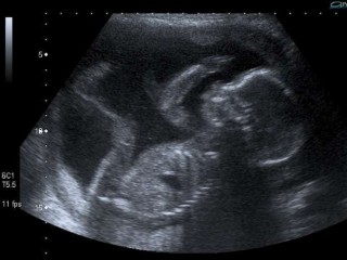 Ảnh: Flickr (CC BY-SA 2.0)