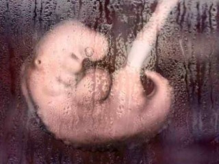 Right to Life, một nhóm vận động hành lang ủng hộ việc bảo vệ sự sống, cho biết trong một tuyên bố vào ngày 10 tháng 9 rằng sự gia tăng này trùng hợp với một biện pháp tạm thời cho phép cái gọi là việc phá thai y tế ‘Do-It-Yourself’ tại nhà riêng trong thời gian cách ly xã hội do đại dịch Covid-19